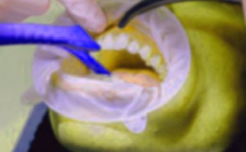 ����ӛ����(���x15ƪ)