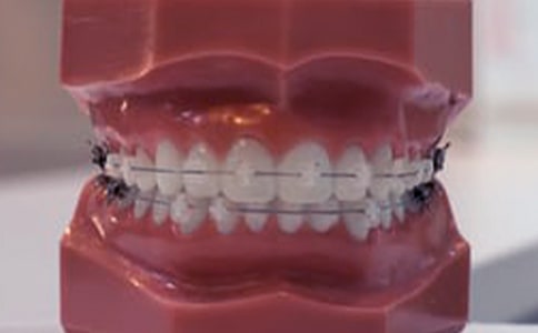 智齒長(zhǎng)在牙齦里怎么辦