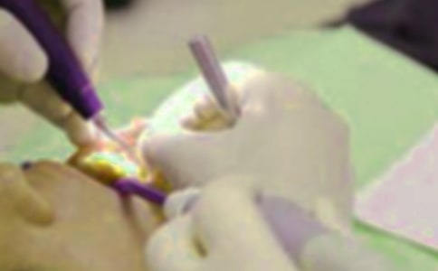 【熱】拔牙記作文