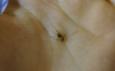 小熊和蚊子的'看圖寫話