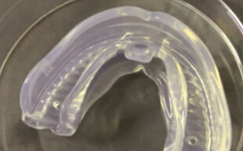 戴牙套感覺作文550字