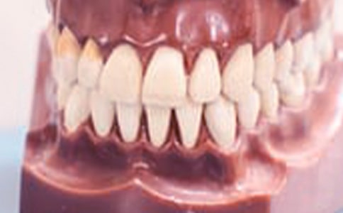 牙齦腫痛后牙齒松動的注意事項是什么