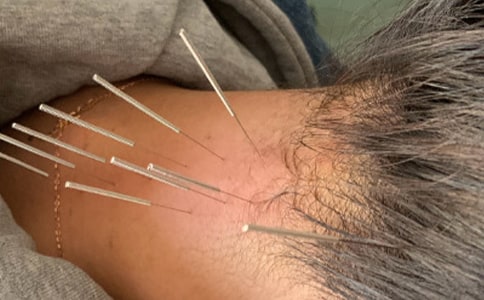 針灸科自我鑒定(精選17篇)