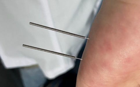 ᘾĿƹ���Ӌ(j��)��